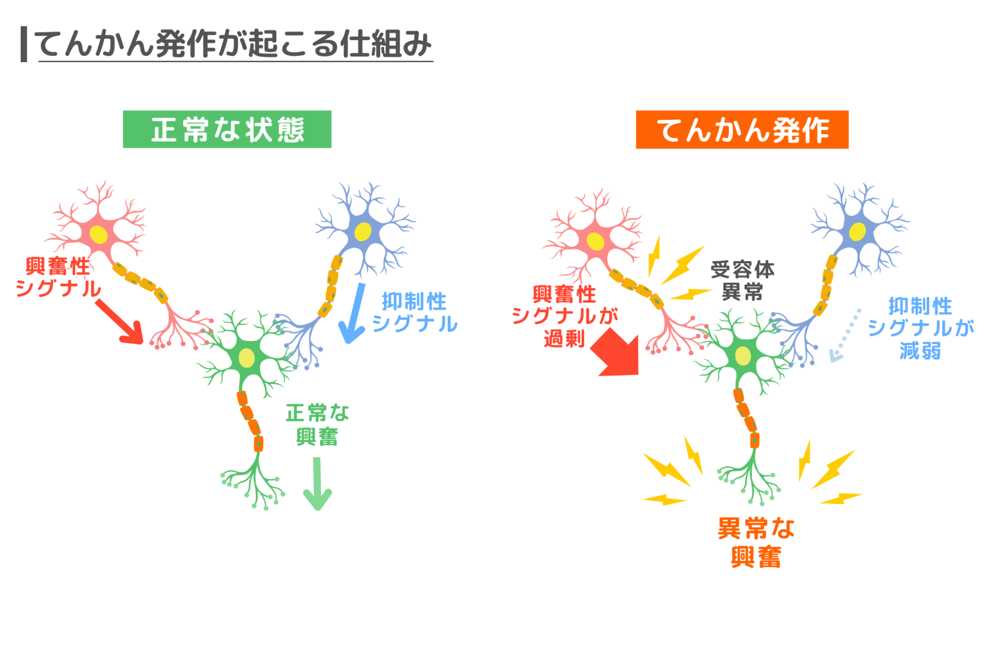 てんかん発作が起こる仕組みの図